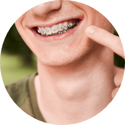 brackets