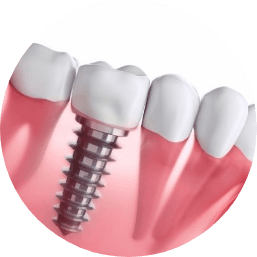 brackets