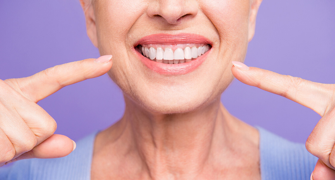 Implantes Dentales en Saltillo: Recupera tu Sonrisa Completa y Funcional con Belle-Dent