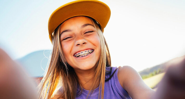 Mantener una limpieza adecuada alrededor de los brackets es clave.