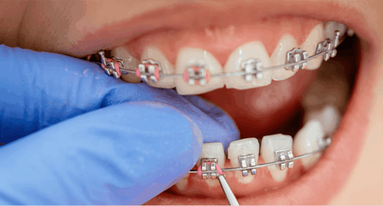 En Belle-Dent, nuestra calidad de servicio incluye brindarte soluciones prácticas.